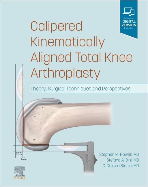Calipered Kinematically aligned Total Knee Arthroplasty: Theory, Surgical Techniques and Perspectives 1st Edition