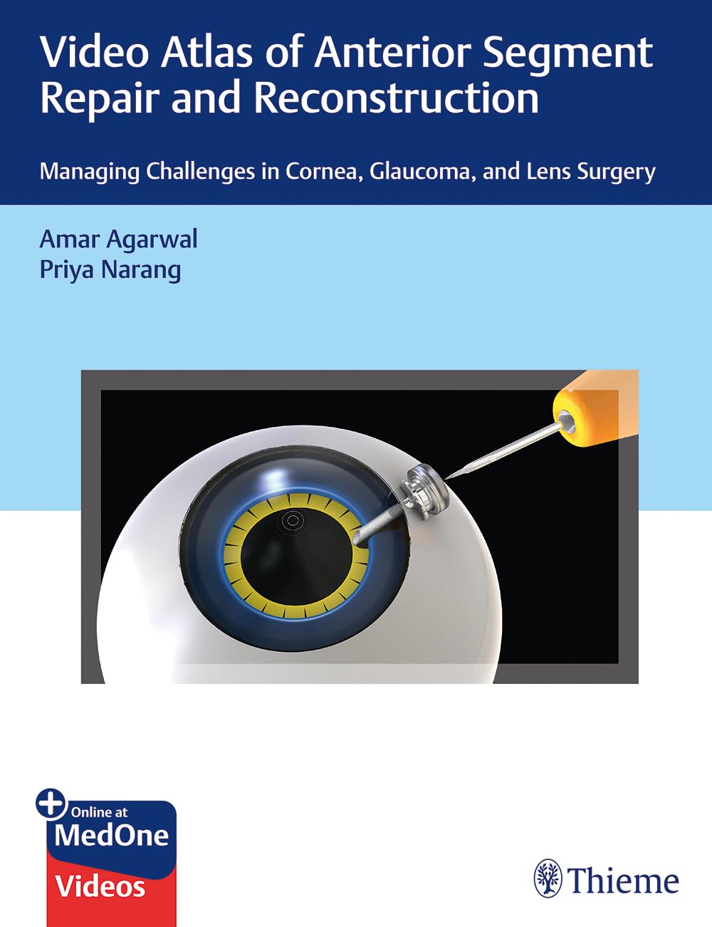 Video Atlas of Anterior Segment Repair and Reconstruction: Managing Challenges in Cornea, Glaucoma, and Lens Surgery Illustrated Edition