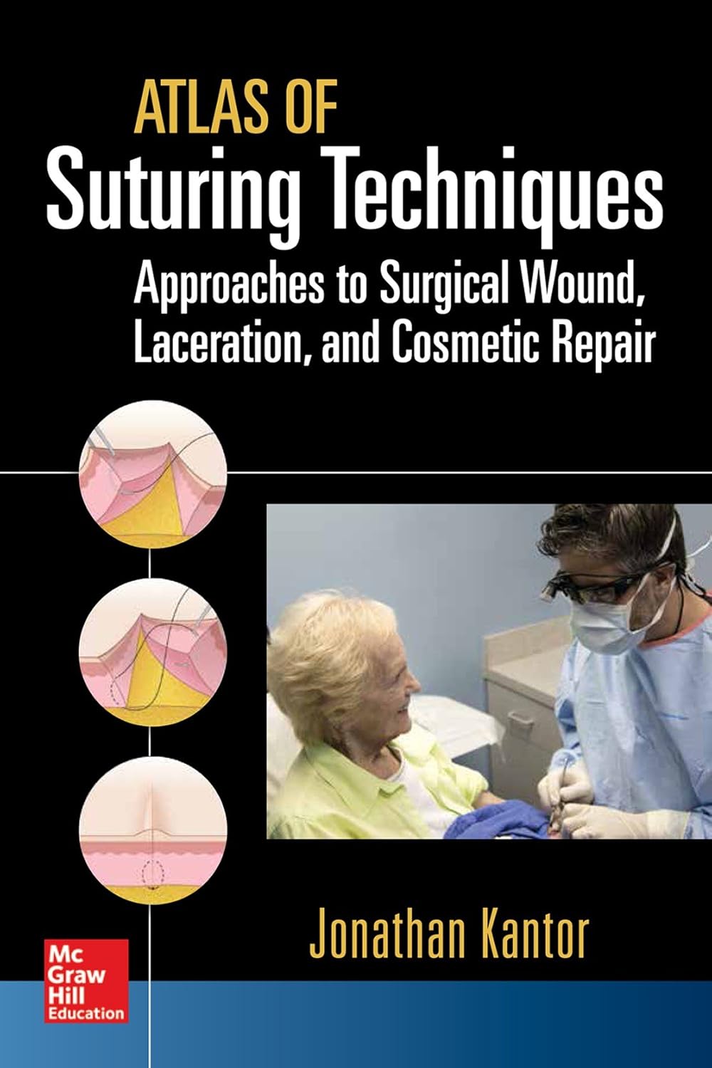 sky Jonathan kantor es Atlas of Suturing Techniques: Approaches to Surgical Wound, Laceration, and Cosmetic Repair