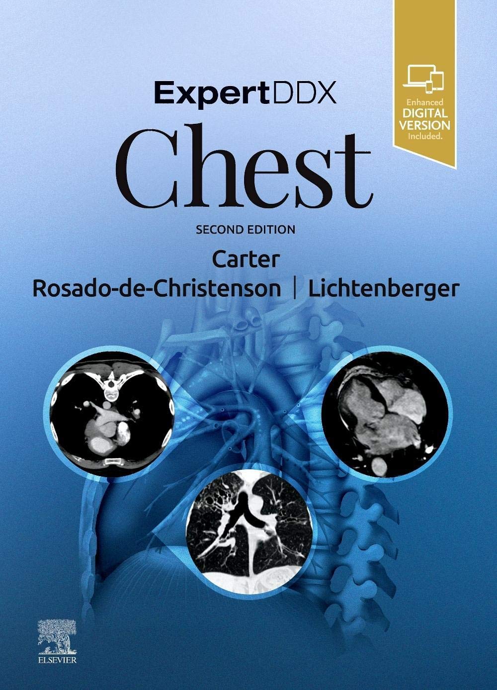 ExpertDDx: Chest 2nd Edition