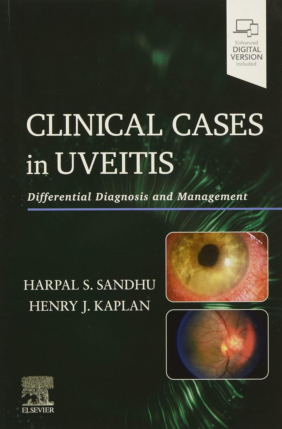 Clinical Cases in Uveitis: Differential Diagnosis and Management 1st Edition