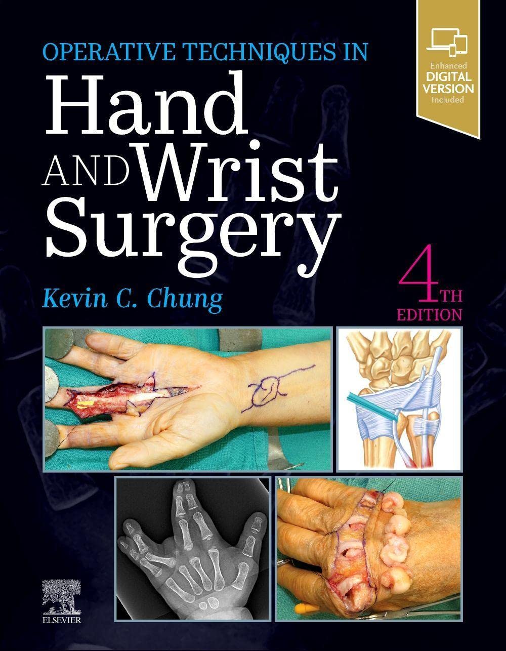 Operative Techniques: Hand and Wrist Surgery 4th Edition