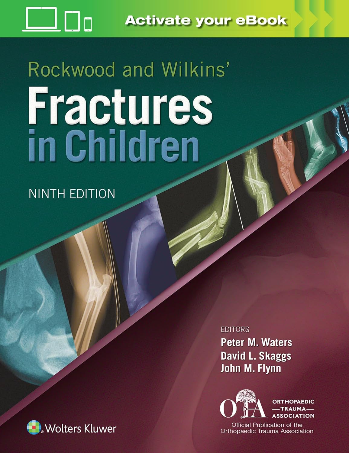 Rockwood and Wilkins Fractures in Children 9th Edition