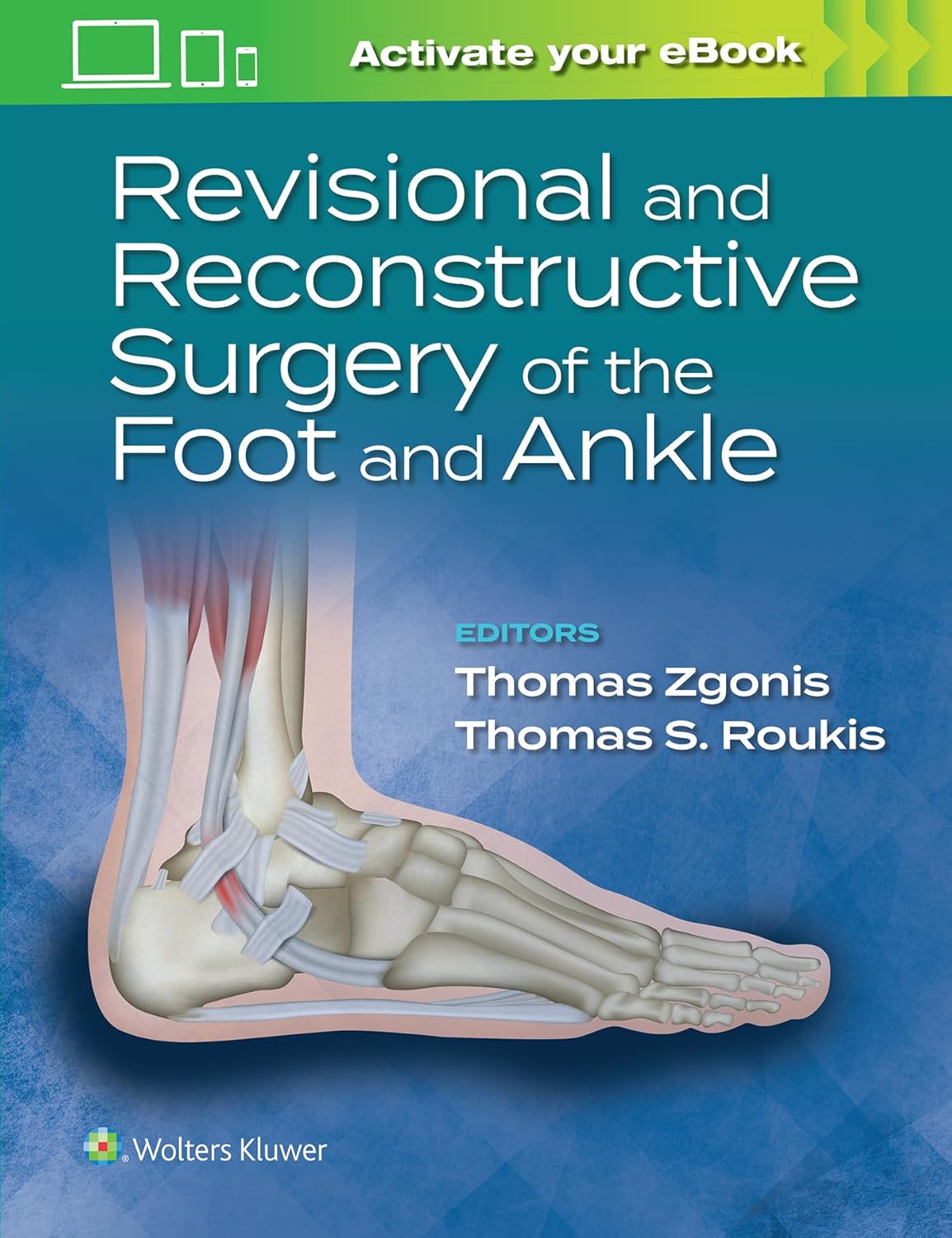 Revisional and Reconstructive Surgery of the Foot and Ankle First Edition