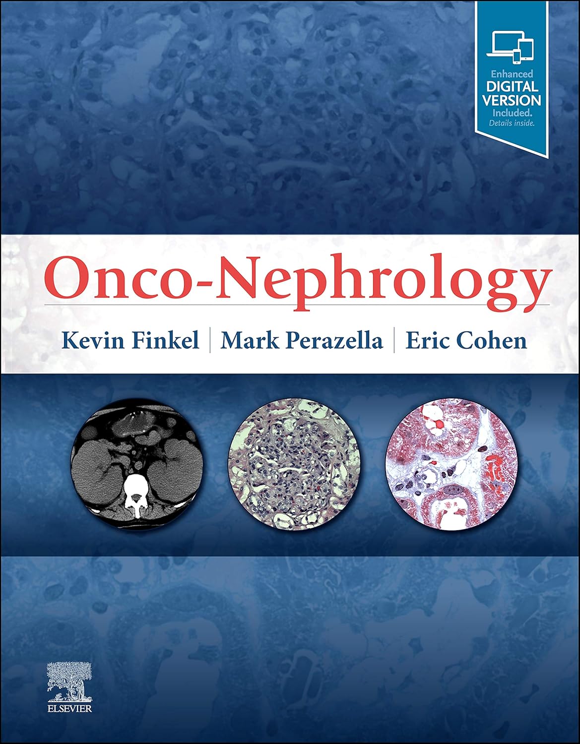 Onco-Nephrology, 1st Edition