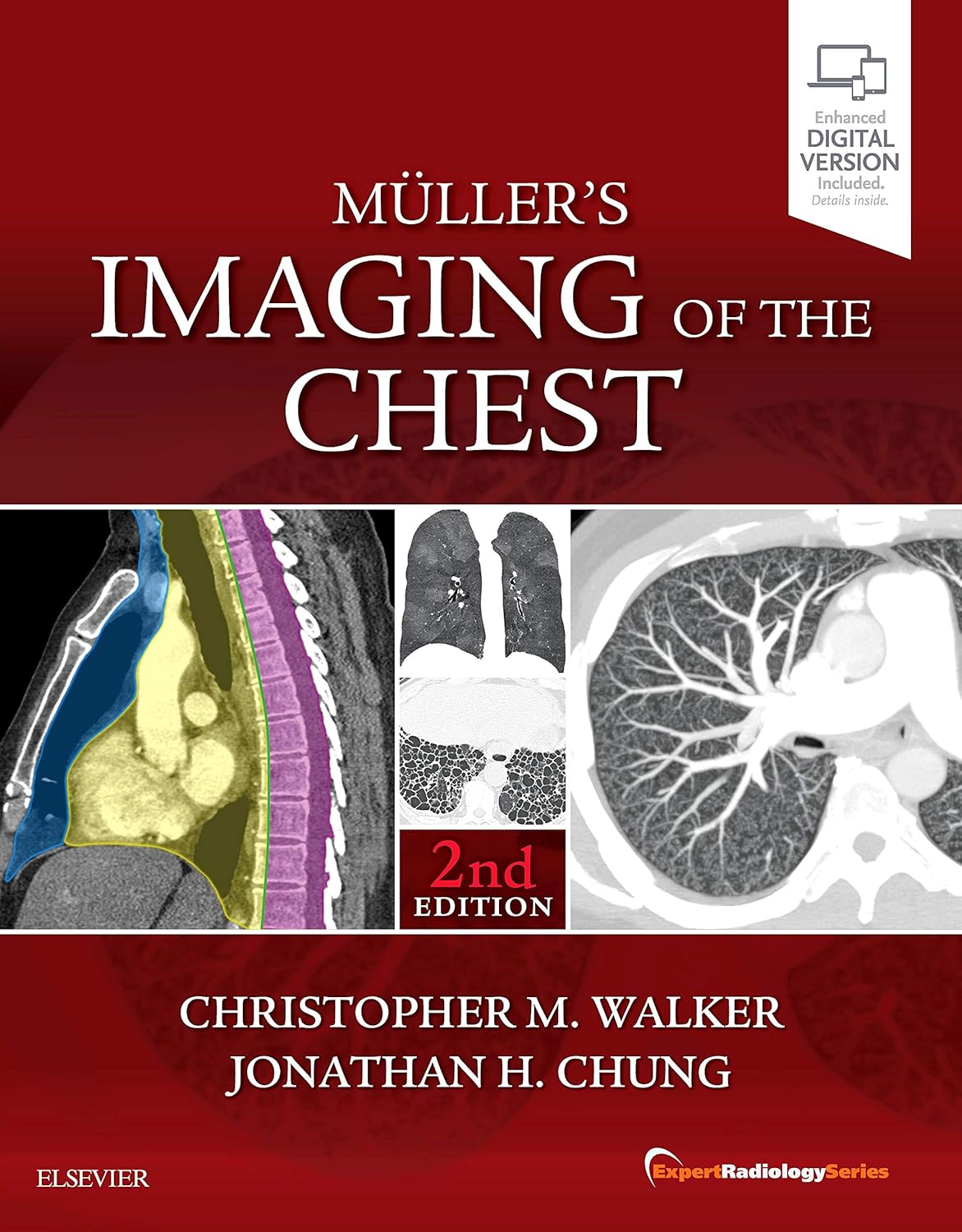 Muller's Imaging of the Chest: Expert Radiology Series 2nd Edition