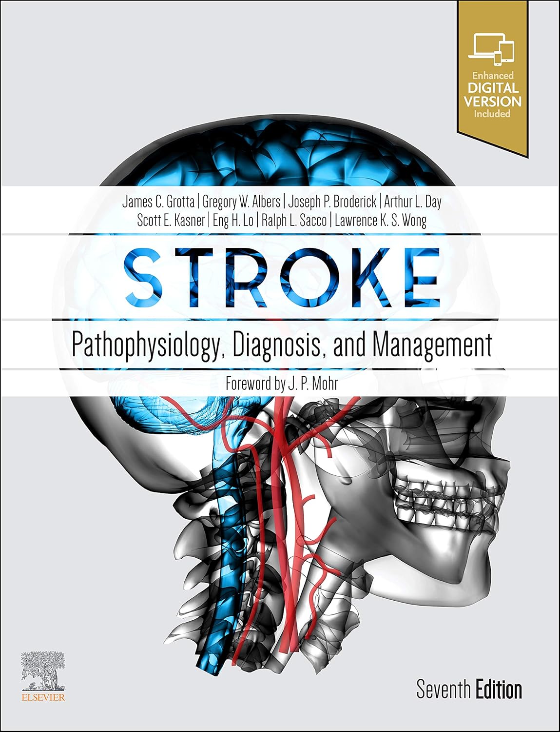 Stroke: Pathophysiology, Diagnosis, and Management 7th Edition