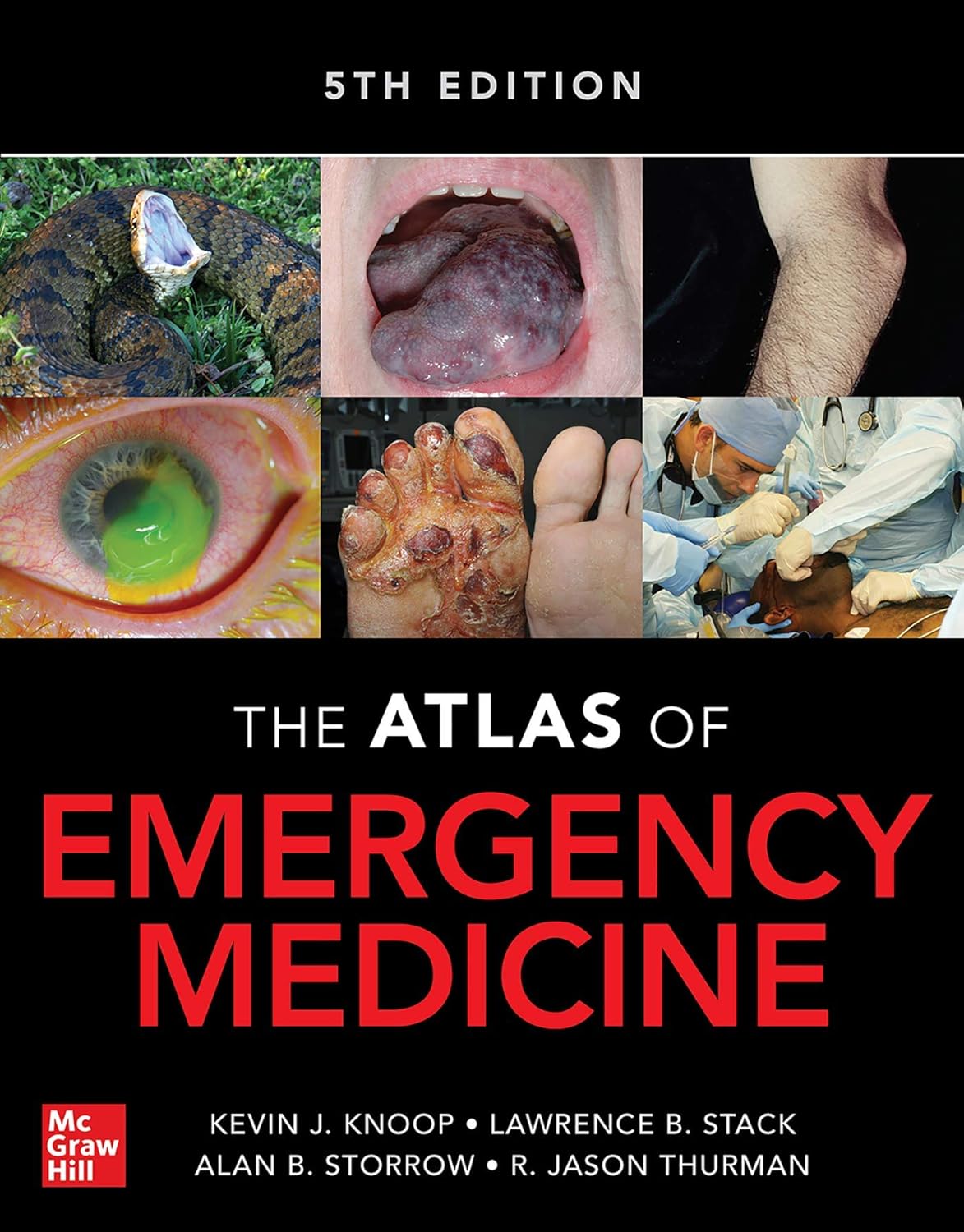 Atlas of Emergency Medicine 5th Edition 5th Edition