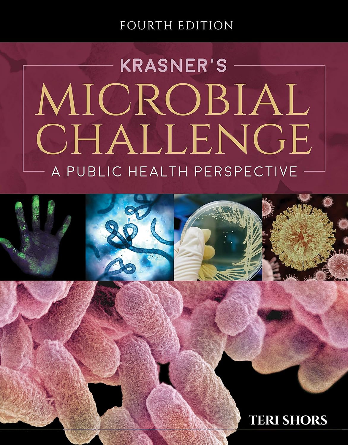 Krasner's Microbial Challenge: A Public Health Perspective