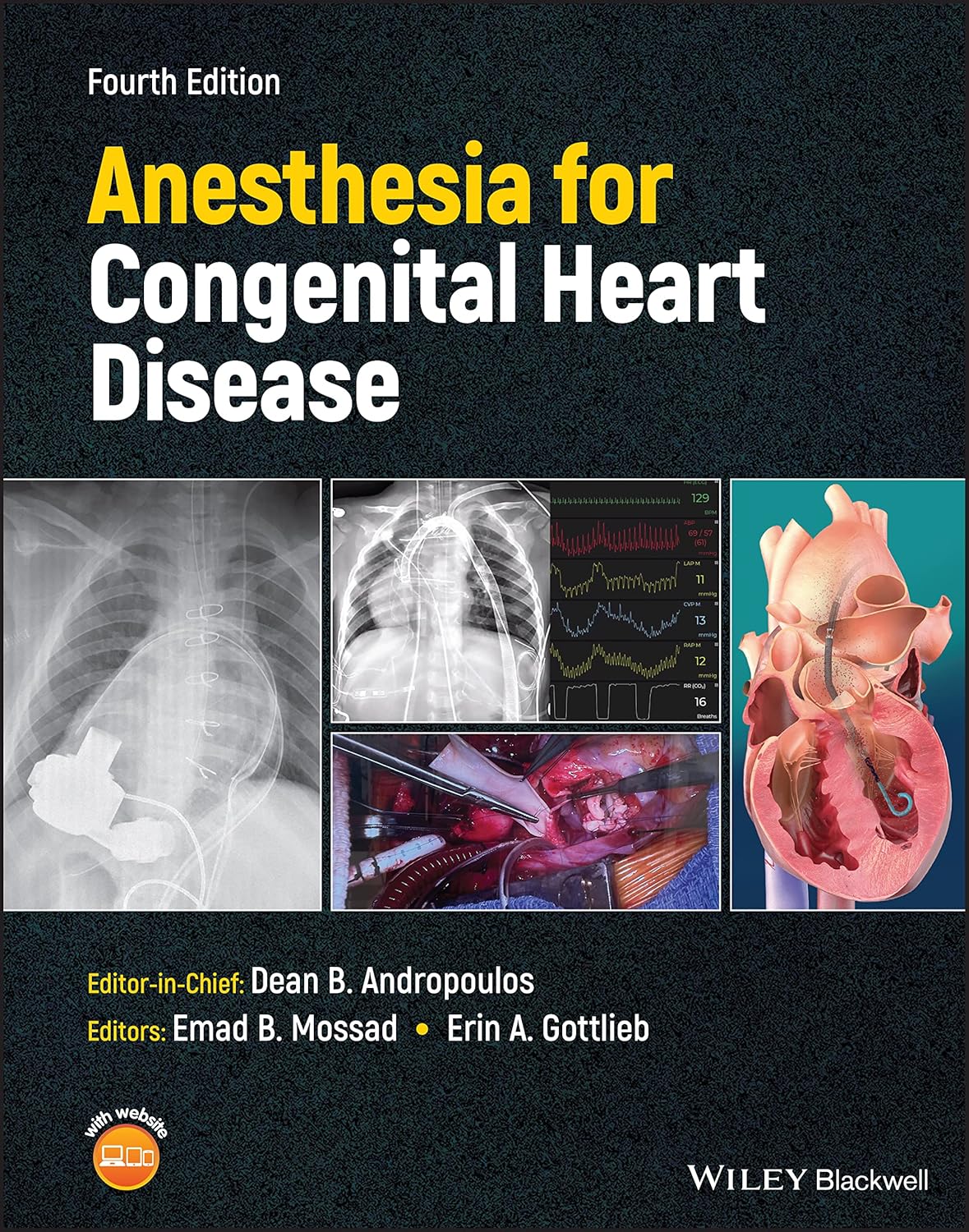 Anesthesia for Congenital Heart Disease 4th Edition