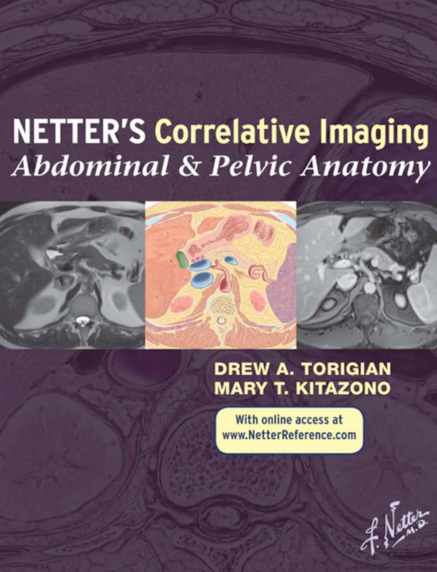 Netter’s Correlative Imaging: Abdominal and Pelvic Anatomy - INK, 1st Edition