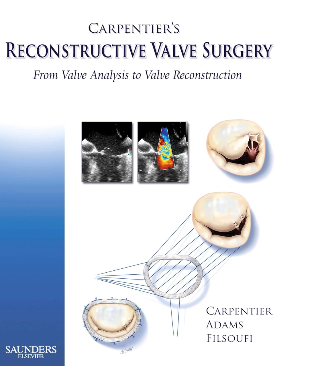 Carpentier's Reconstructive Valve Surgery, 1st Edition