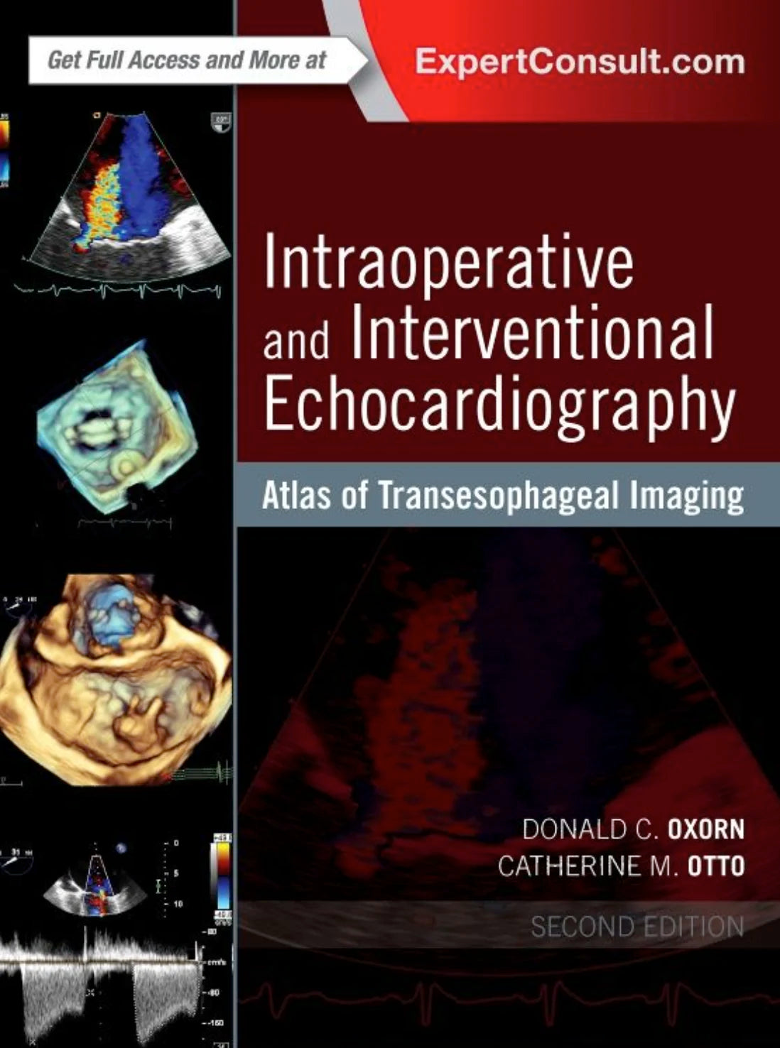 Intraoperative and Interventional Echocardiography, 2nd Edition