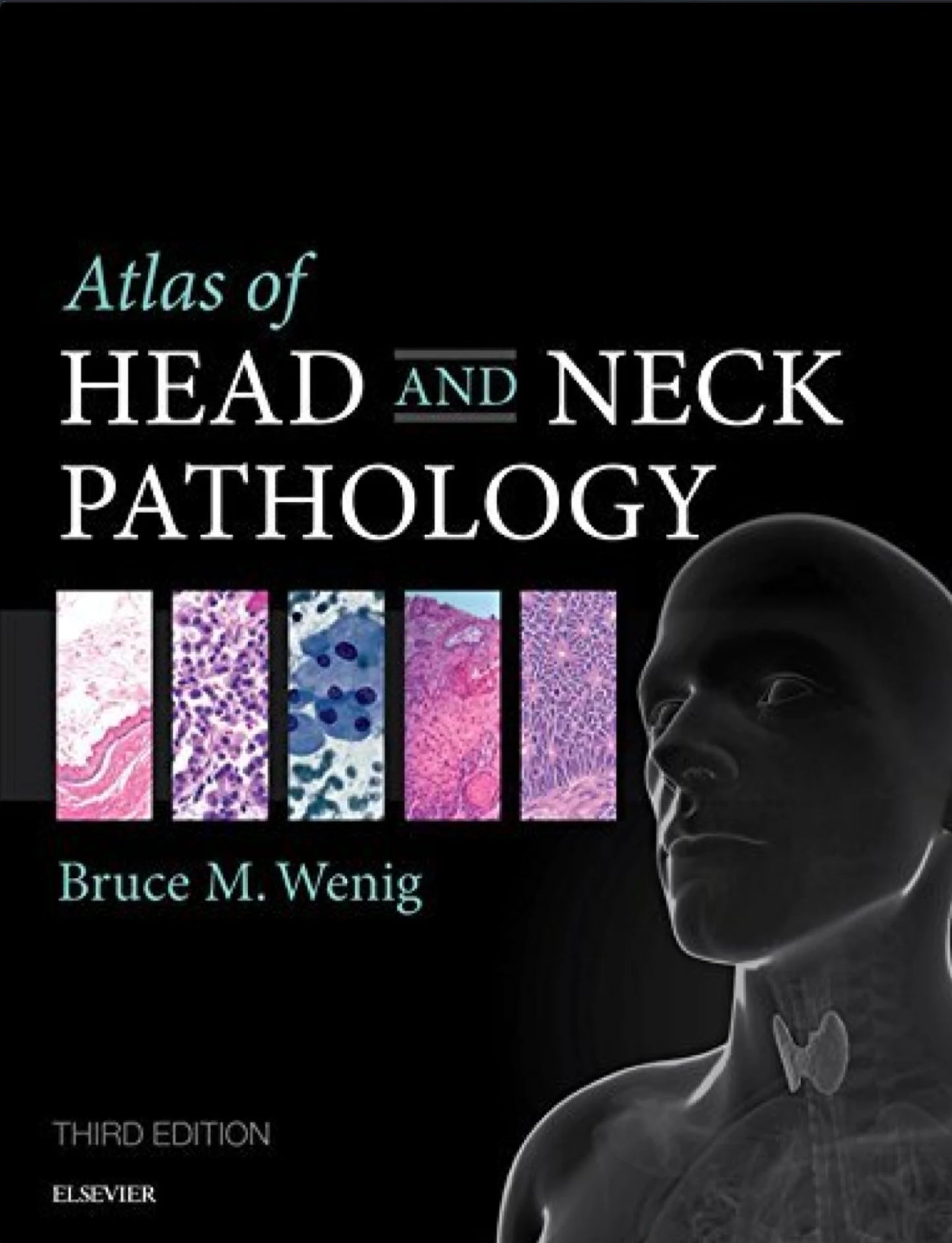 Atlas of Head and Neck Pathology E-Book, 3rd Edition