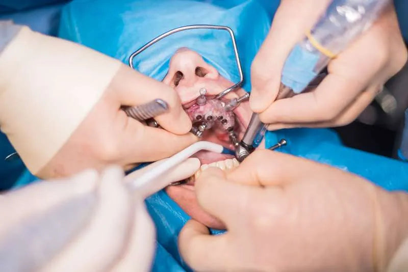 Oral Maxillofacial Surgery