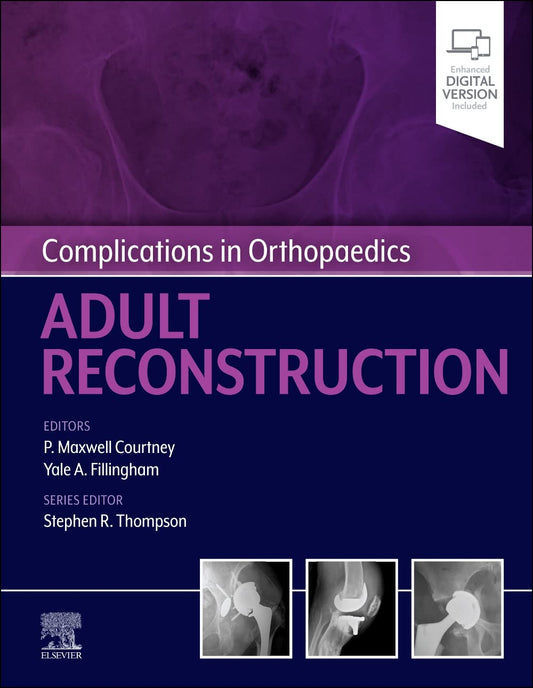 Complications in Orthopaedics: Adult Reconstruction 1st Edition