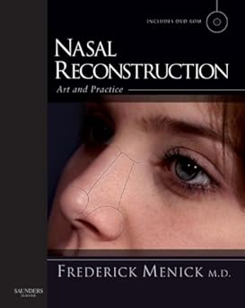Nasal Reconstruction: Art and Practice 1st Edition, Kindle Edition