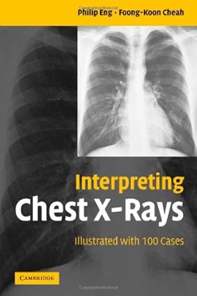 Interpreting Chest X-Rays: Illustrated with 100 Cases 1st Edition