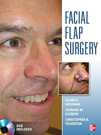 Facial Flaps Surgery 1st Edition
