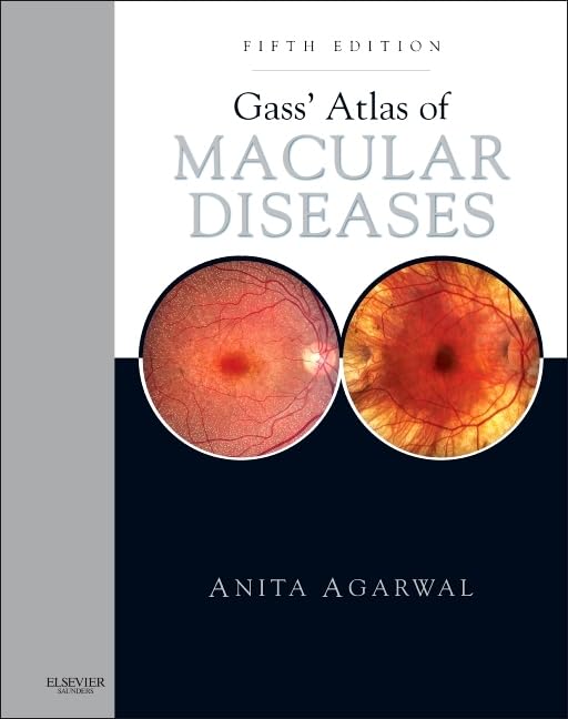 Gass' Atlas of Macular Diseases: 2-Volume Set - Expert Consult 5th Edition
