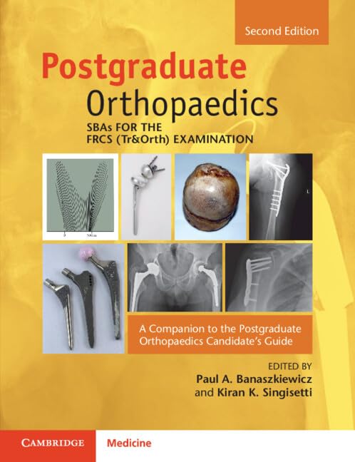 SBAs for the FRCS (Tr&Orth) Examination: A Companion to the Postgraduate Orthopaedics Candidate's Guide 2nd Edition