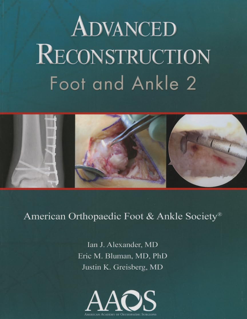 Advance Reconstruction Foot and Ankle 2 1st Edition