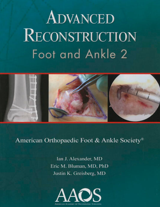 Advance Reconstruction Foot and Ankle 2 1st Edition