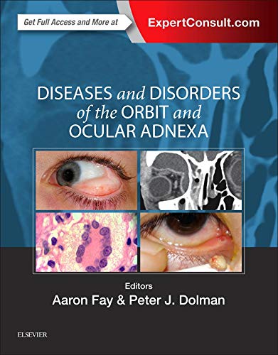 Diseases and Disorders of the Orbit and Ocular Adnexa 1st Edition