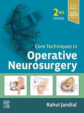 Core Techniques in Operative Neurosurgery: Expert Consult - Online and Print 2nd Edition