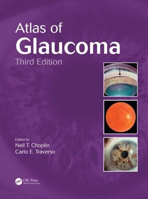 Atlas of Glaucoma 3rd Edition