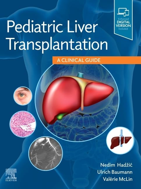 Pediatric Liver Transplantation, 1st Edition