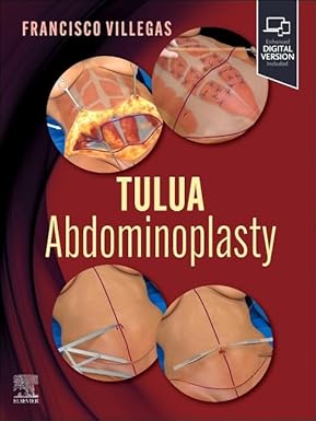 TULUA Abdominoplasty: Transverse Plication Technique 1st Edition