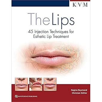 The Lips: 45 Injection Techniques for Esthetic Lip Treatment 1st Edition