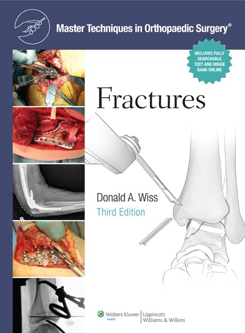 Master Techniques in Orthopaedic Surgery: Fractures Third Edition