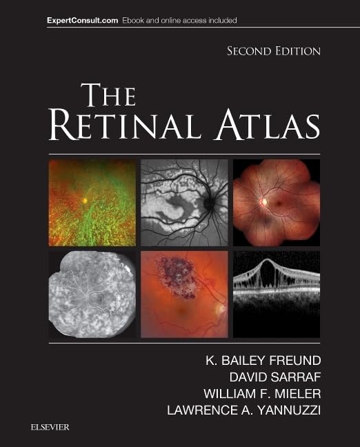 The Retinal Atlas 2nd Edition