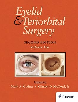 Eyelid and Periorbital Surgery 2nd Edition