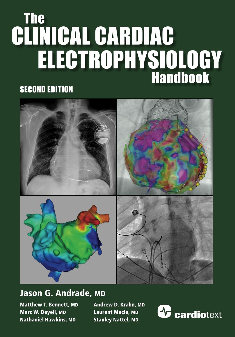 The Clinical Cardiac Electrophysiology Handbook Second Edition 2nd Edition