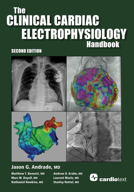 The Clinical Cardiac Electrophysiology Handbook Second Edition 2nd Edition