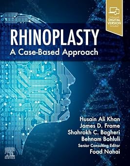 Rhinoplasty: a Case-based approach 1st Edition