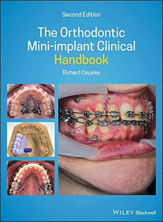 The Orthodontic Mini-implant Clinical Handbook 2nd Edition