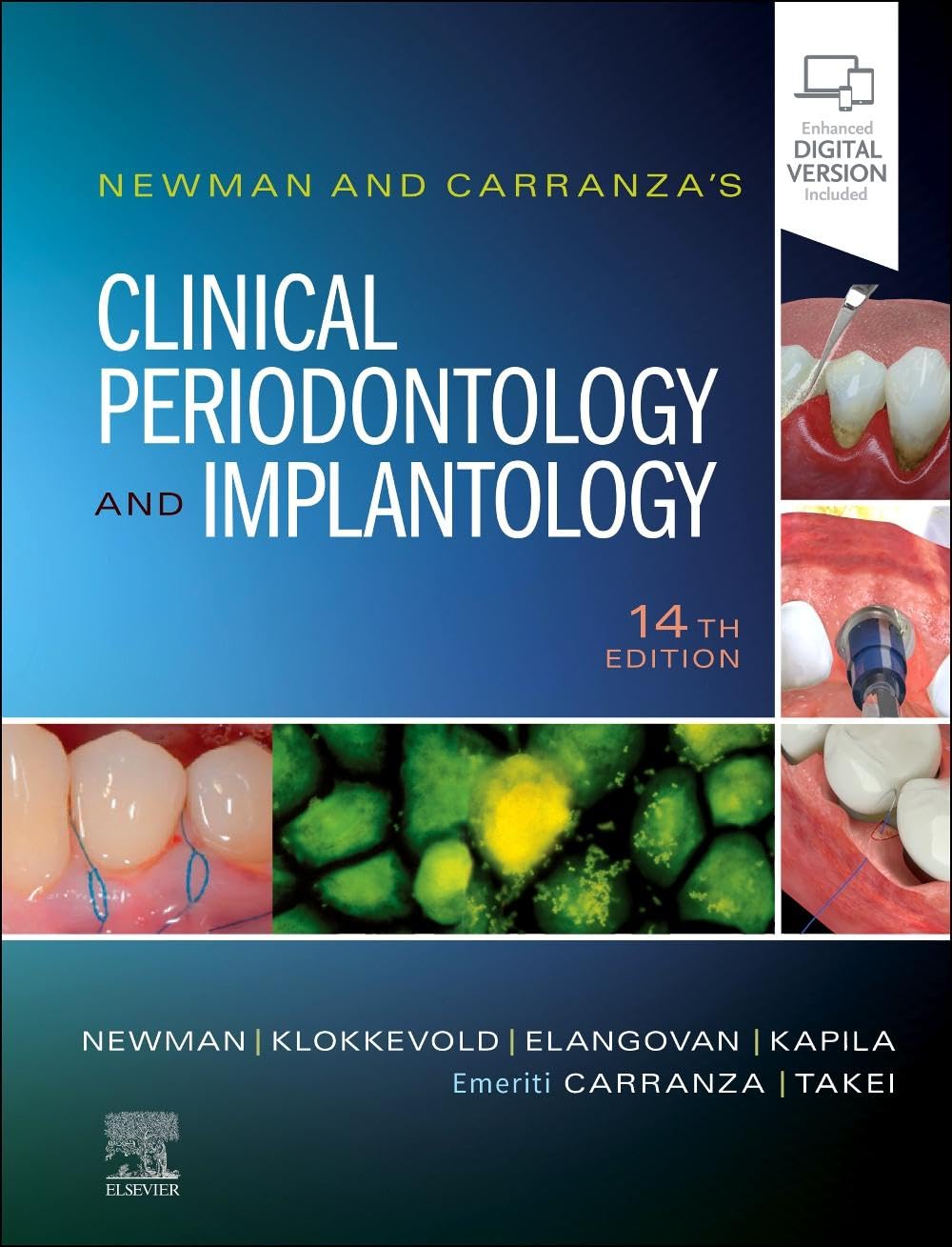 Newman and Carranza's Clinical Periodontology and Implantology 14th Edition