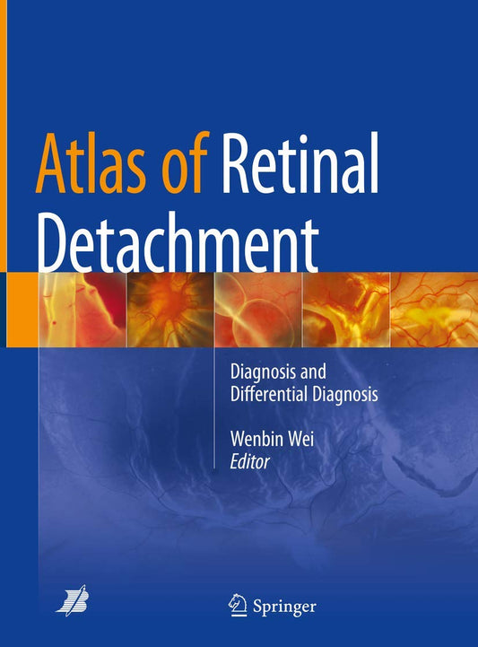 Atlas of Retinal Detachment: Diagnosis and Differential Diagnosis 1st ed. 2018 Edition