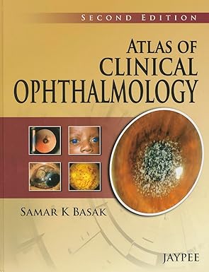 Atlas of Clinical Ophthalmology 2nd Edition