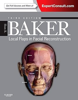 Local Flaps in Facial Reconstruction, 3e 3rd Edition