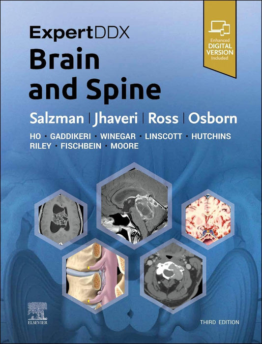 ExpertDDx- Brain and Spine, 3rd Edition
