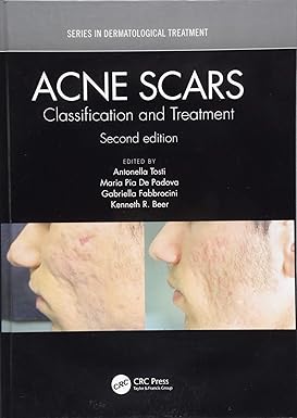 Acne Scars: Classification and Treatment, Second Edition (Series in Dermatological Treatment) 2nd Edition