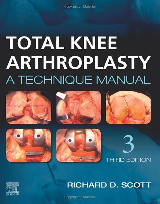 Total Knee Arthroplasty: A Technique Manual 3rd Edition