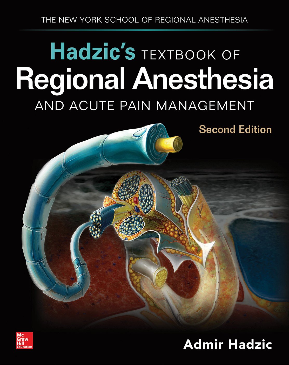 Hadzic's Textbook of Regional Anesthesia and Acute Pain Management, 2nd Edition