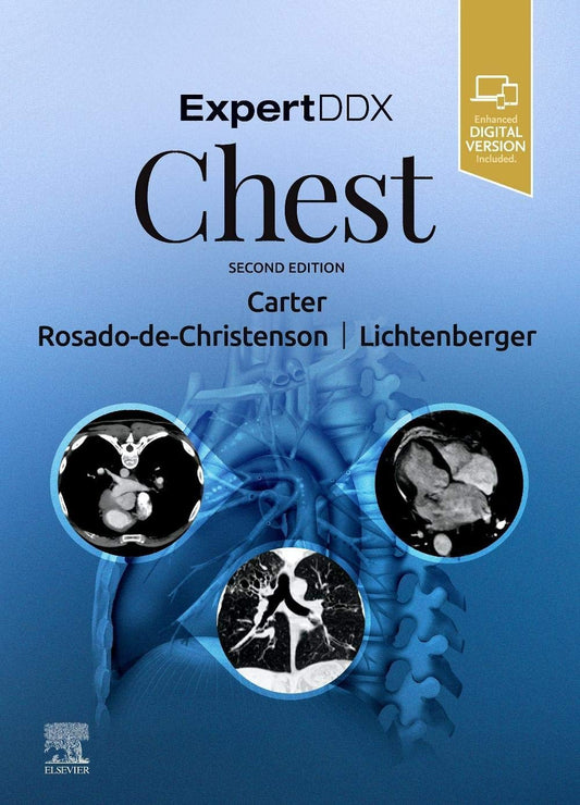 ExpertDDx: Chest 2nd Edition