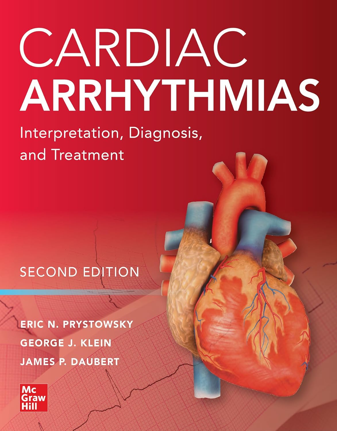 Cardiac Arrhythmias: Interpretation, Diagnosis and Treatment, Second Edition 2nd Edition